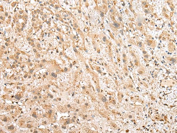 Polyclonal Rabbit anti-Human NUDT12 Antibody (IHC, WB)