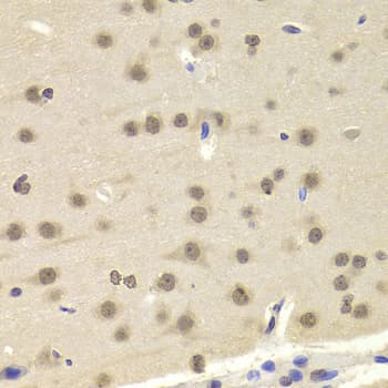 TEL-2 / ETV7 Antibody