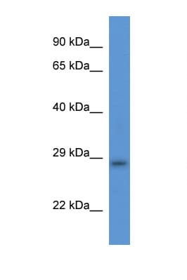 TMEM33 Antibody (aa120-169)
