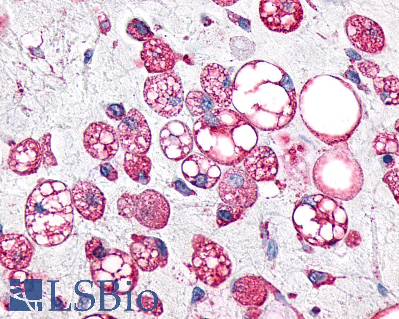 PathPlus™ GPR34 Antibody (C-Terminus)