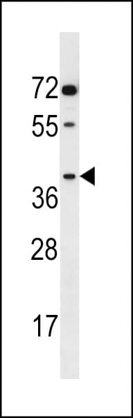 AKR1E2 Antibody (aa291-320)