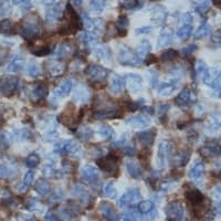 Polyclonal Rabbit anti-Human NCF1 / p47phox / p47 phox Antibody (C-Terminus, IHC, WB)