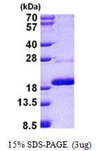 Human MAGOHB / Mago Protein (Recombinant His)