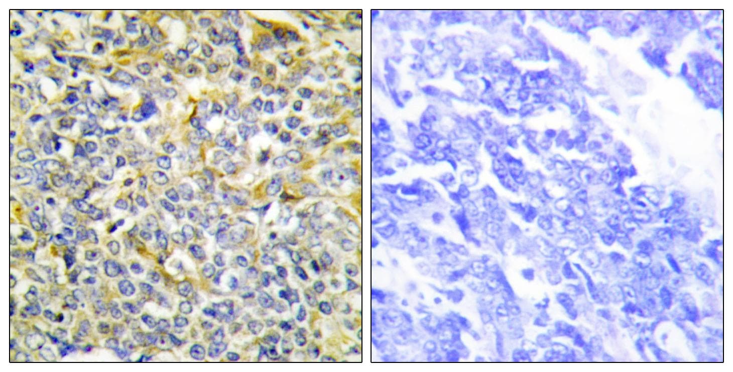 TNFAIP8 / SCC-S2 Antibody