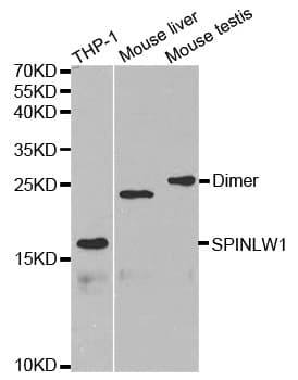 Polyclonal Rabbit anti-Human SPINLW1 / EPPIN Antibody (IHC, IF, WB)