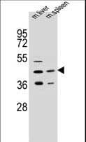AWAT2 / DGAT2L4 Antibody (aa303-331)