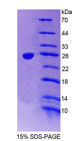 Mouse DLG5 Protein (Recombinant His-T7, N-terminus)