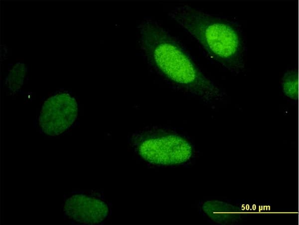 IHC-plus™ Monoclonal Mouse anti-Human YAP / YAP1 Antibody (clone 2F12, IHC, IF, WB)