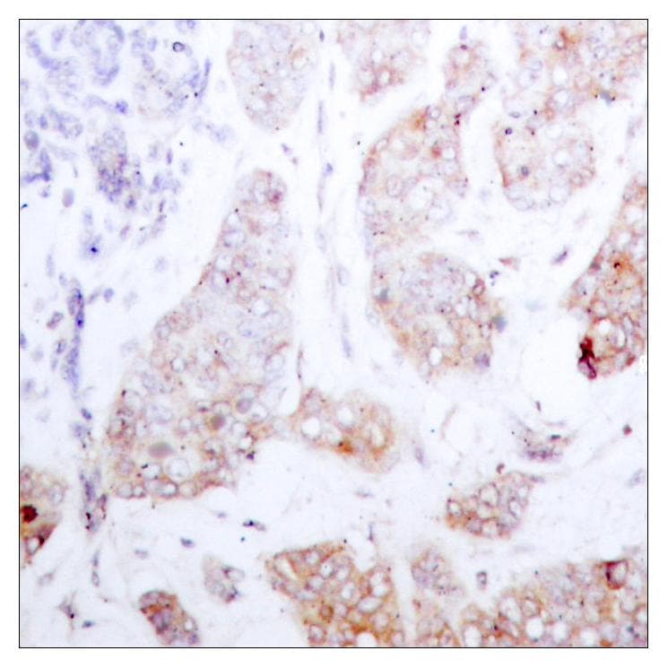 Polyclonal Rabbit anti-Human RAF1 / RAF Antibody (p259, IHC, WB)