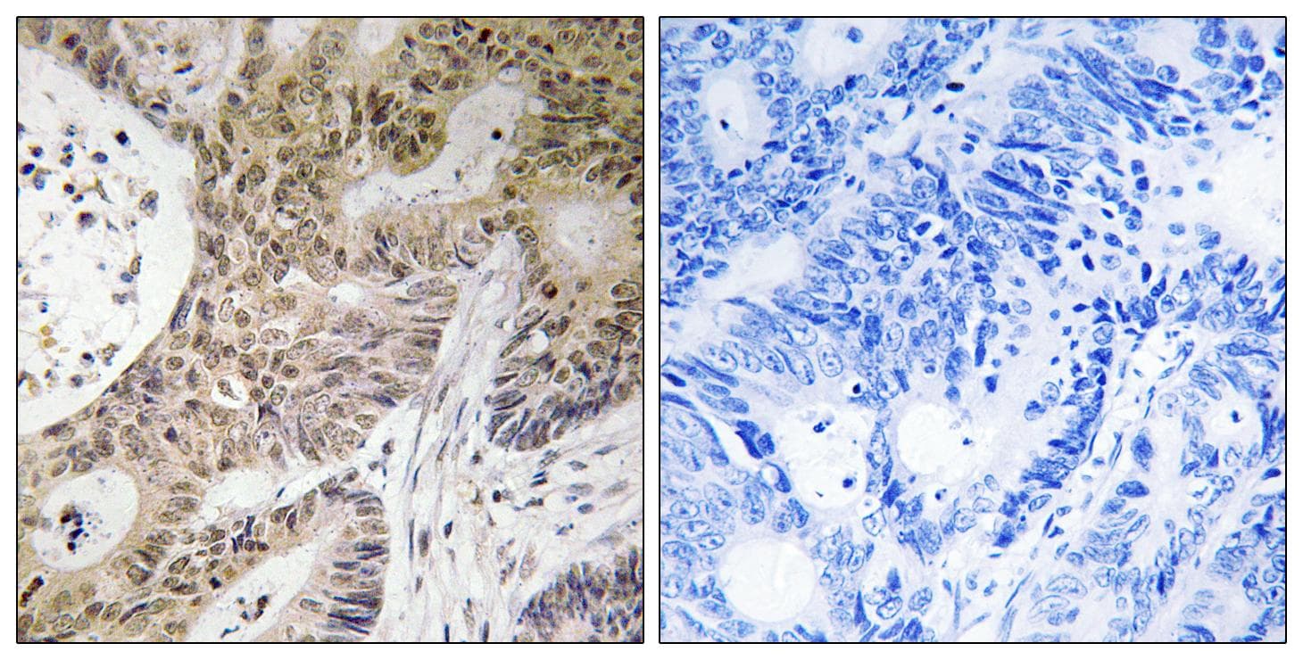 PRPF6 / TOM Antibody