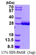 Human HSCB Protein (Recombinant His)