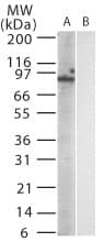Monoclonal Mouse anti-Mouse Tlr11 Antibody (clone 15F1215, aa750-850, WB)