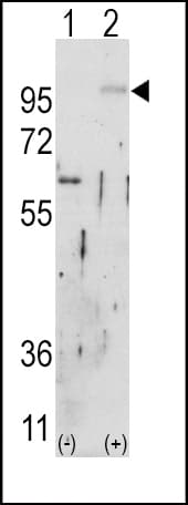 FGFR2 / FGF Receptor 2 Antibody