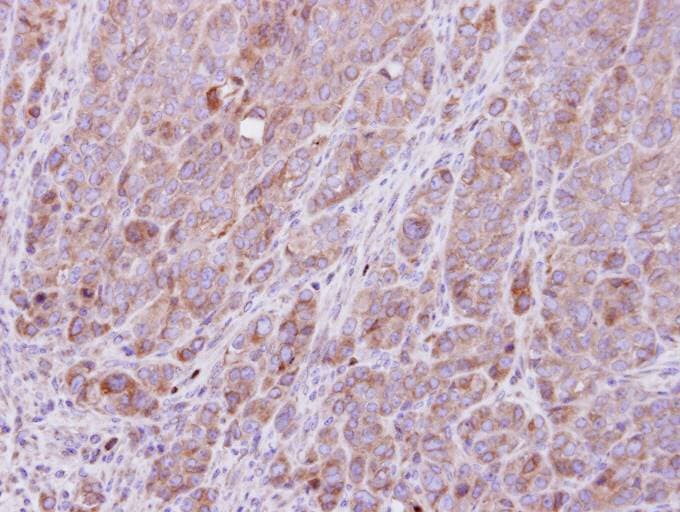 Rho Kinase / ROCK1 Antibody (aa107-371)