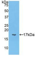 VIP Antibody (aa28-159)