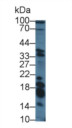 GAL / Galanin Antibody (aa32-122)