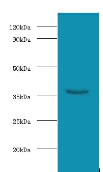 Polyclonal Rabbit anti-Human WDR54 Antibody (WB)