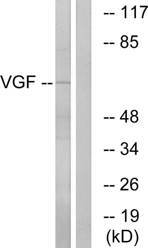 Polyclonal Rabbit anti-Human VGF Antibody (IHC, WB)