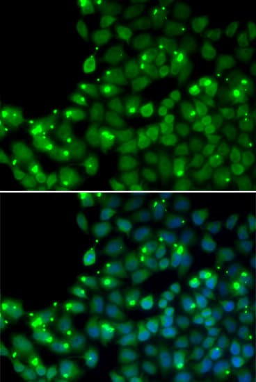 IHC-plus™ MGMT Antibody