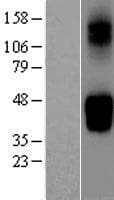 SLC2A9 / GLUT9 Protein (Over-Expression Lysate Myc-DDK (Flag))