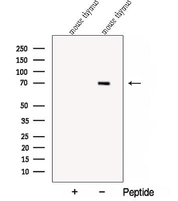 COL23A1 / Collagen XXIII Antibody