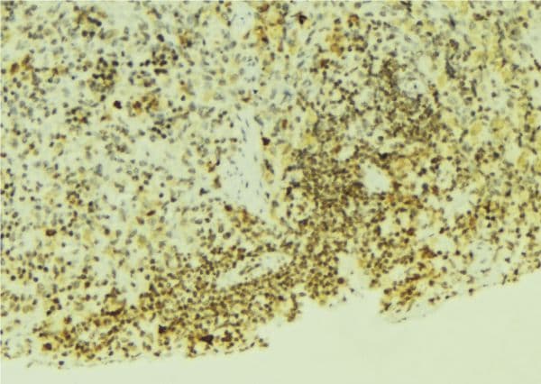 Polyclonal Rabbit anti-Human EGLN1 / PHD2 Antibody (IHC, IF, WB)