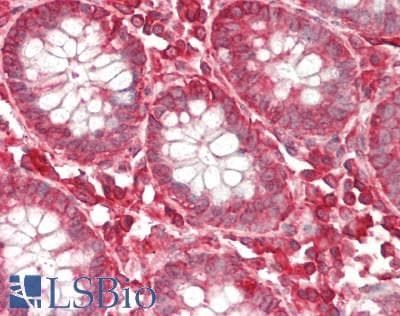 IHC-plus™ RPL5 / Ribosomal Protein L5 Antibody (aa247-297)