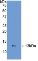 FABP1 / L-FABP Antibody (aa2-127, APC)