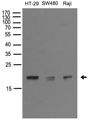 Polyclonal Rabbit anti-Human NUDT15 Antibody (WB)
