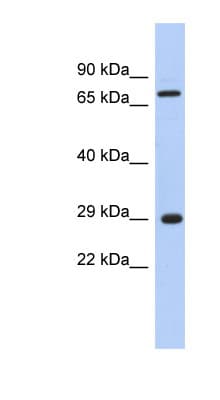 AKTIP / FTS Antibody (C-Terminus)