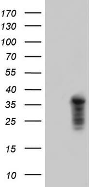Monoclonal Mouse anti-Human TNNT2 / CTNT Antibody (clone OTI7B1, IHC, WB)