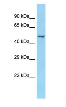 CCT2 / CCT Beta Antibody (aa89-138)