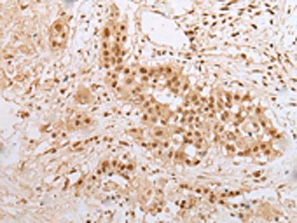 ZNF22 Antibody