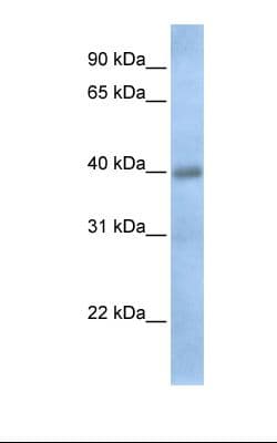 Disulfide Isomerase / TXNDC15 Antibody (aa254-303)