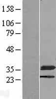 NMRAL1 / HSCARG Protein (Over-Expression Lysate Myc-DDK (Flag))