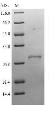 Human NXPH2 Protein (Recombinant 6His, N-terminus)