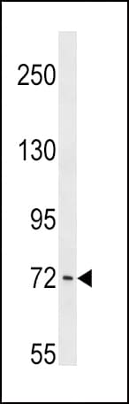 PCK1 Antibody (aa592-622)