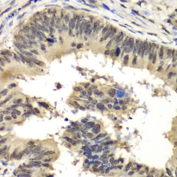 Polyclonal Rabbit anti-Human RBBP5 Antibody (IHC, IF, WB)