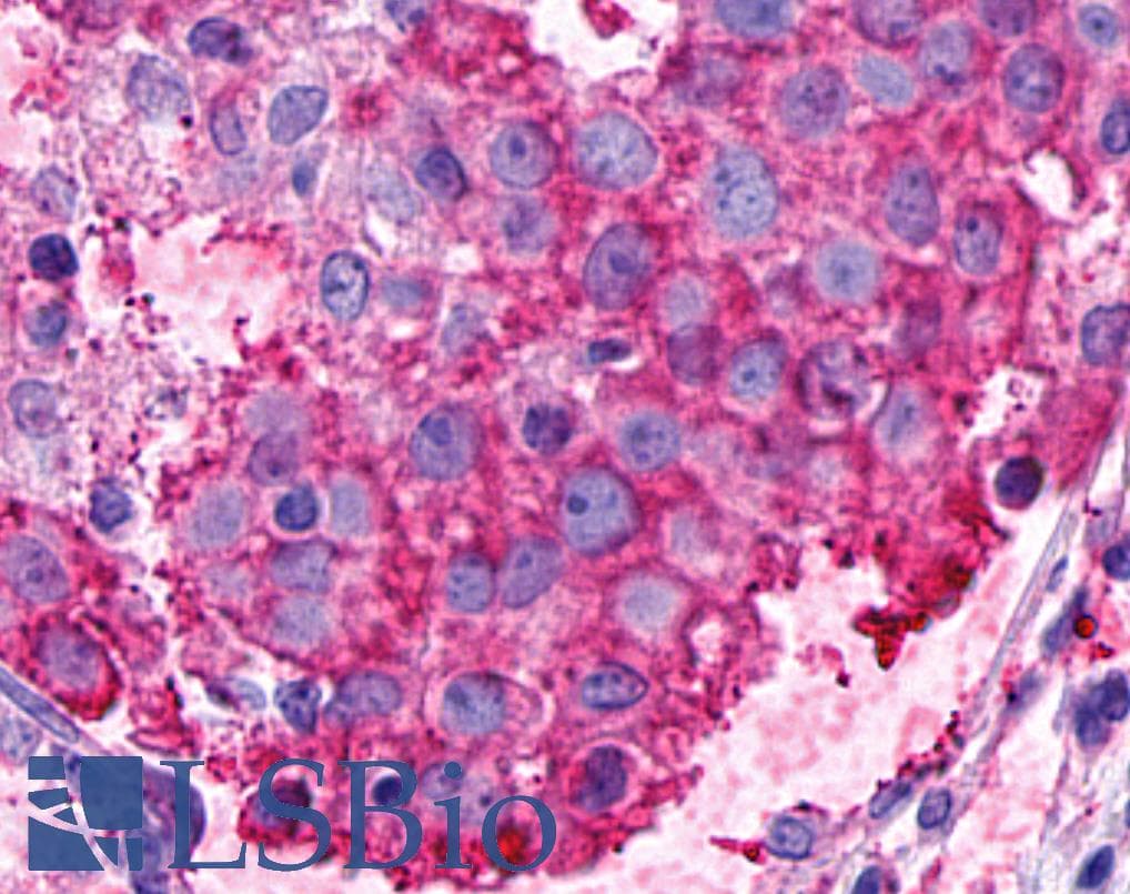 PathPlus™ ADGRF5 / GPR116 Antibody (N-Terminus)