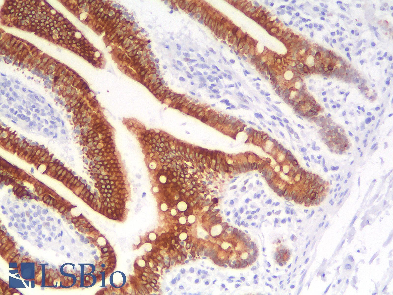 PathPlus™ KRT19 / CK19 / Cytokeratin 19 Antibody (clone rKRT19/799)