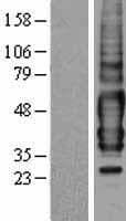 TPRA1 / GPR175 Protein (Over-Expression Lysate Myc-DDK (Flag))