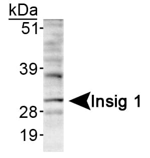 INSIG1 Antibody (Internal, DY488)