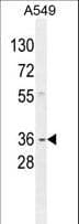 Polyclonal Rabbit anti-Human GNAT3 / Gustducin Antibody (aa78-105, IHC, WB)