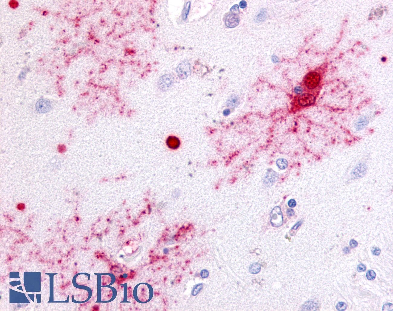 IHC-plus™ PAEL Receptor / GPR37 Antibody (N-Terminus)