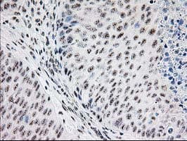 MGLL / Monoacylglycerol Lipase Antibody (clone OTI1C6)