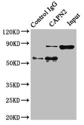 IHC-plus™ CAPN2 / Calpain 2 / M-Calpain Antibody
