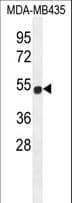 Polyclonal Rabbit anti-Human ZNF286B Antibody (aa96-124, WB)