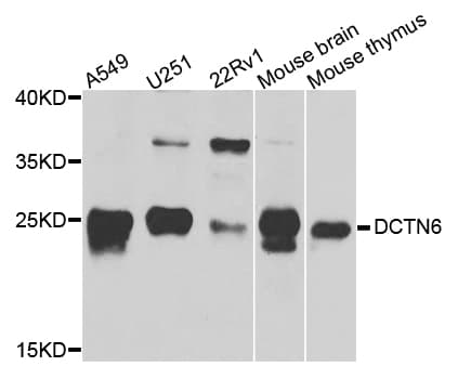 Polyclonal Rabbit anti-Human DCTN6 / Dynactin 6 Antibody (WB)