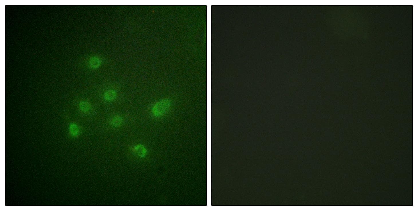 DAPK3 / ZIP Kinase Antibody (phospho-Thr265)