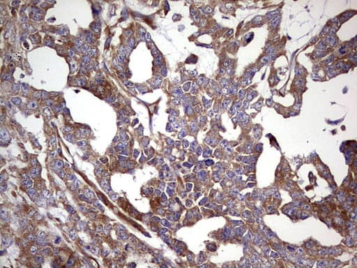 Polyclonal Rabbit anti-Human RELA / NFKB p65 Antibody (aa100-170, IHC, WB)